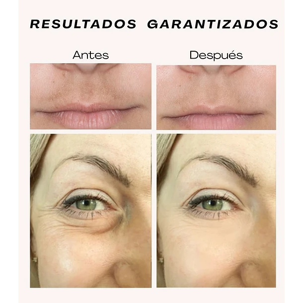 VenusMask: Tu piel radiante en solo 6 semanas