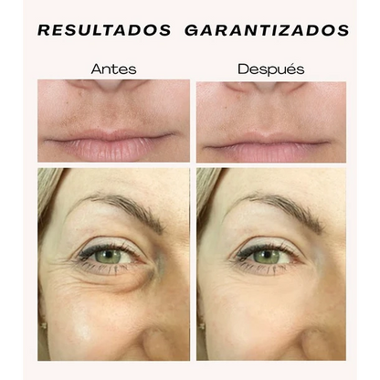 VenusMask: Tu piel radiante en solo 6 semanas