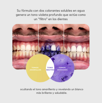 Blanqueador Dental | SmileKit - OFERTA 2X1